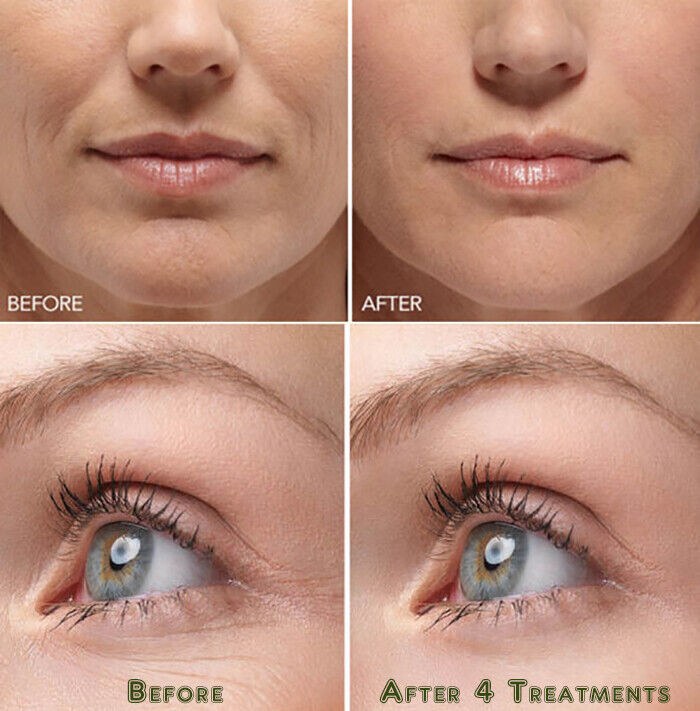 کرم آبرسان کوزارکس اصل | آنجل کازماتیک